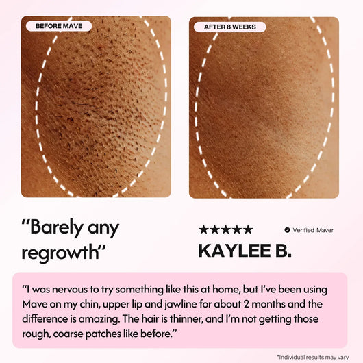 Mave IPL Hair Removal Handset - Smuuv Body