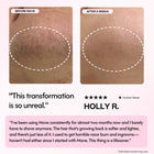 Mave IPL Hair Removal Handset - Smuuv Body