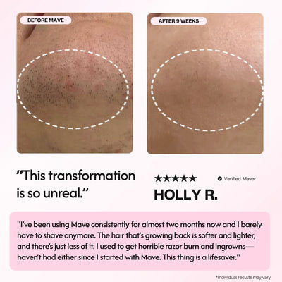 Mave IPL Hair Removal Handset - Smuuv Body